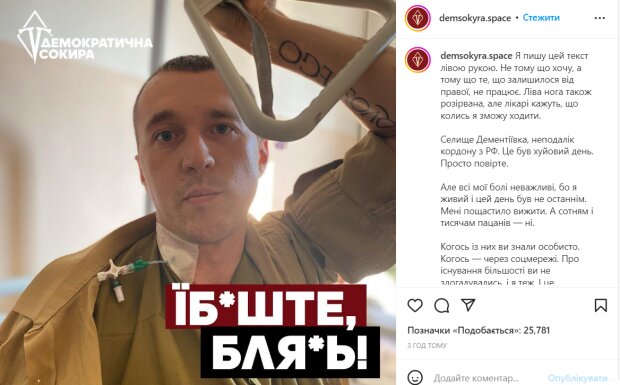Боєць ЗСУ, якому розірвало руку і ногу у бою, дав українцям єдину ...