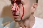 Пострадавший, скриншот из видео