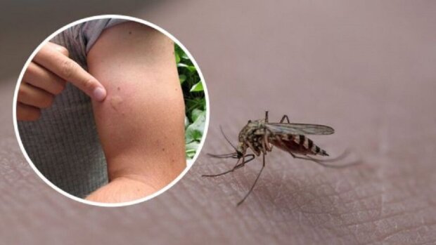 Під шкірою може оселитися “чужий” від одного укусу комара: як розпізнати небезпечну хворобу