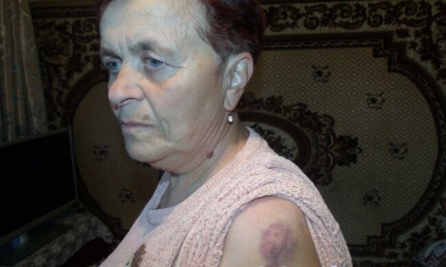 У Тернополі повія побила пенсіонерку за зауваження