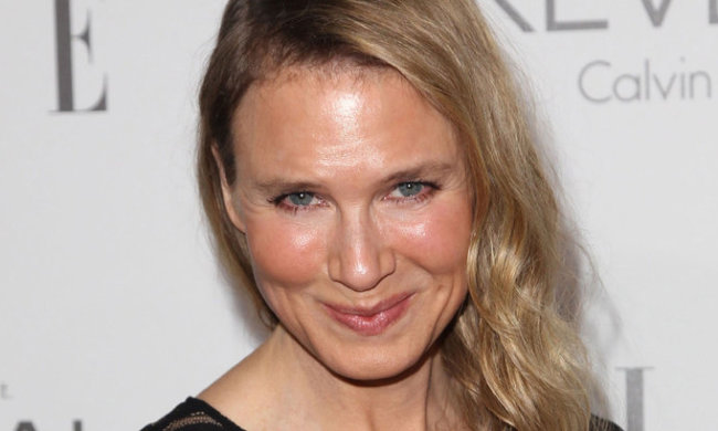 Тихий ужас: 10 бывших красавиц, которых изуродовала пластика