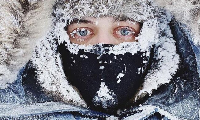 Обморожение