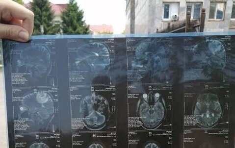 У молодого украинца рак мозга - убитая горем мать умоляет спасти сына