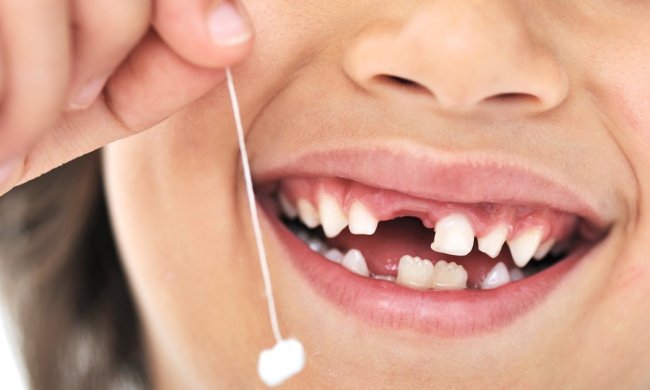 Не поспішайте викидати молочні зуби дітей: це може врятувати життя