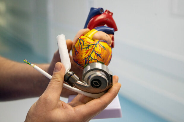 В Киеве впервые имплантировали механическое сердце, хирургам рукоплещет вся Украина