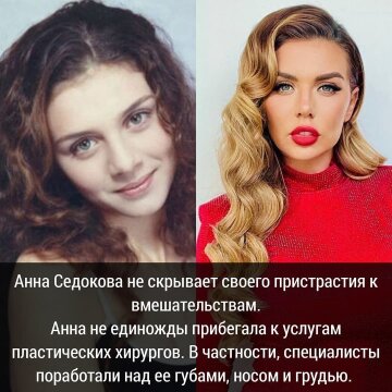 Анна Седокова, фото: Instagram