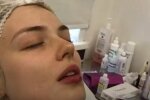 Филлер для губ, скриншот: YouTube