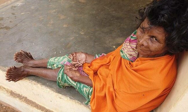 Кумари Наяк / фото: SWNS