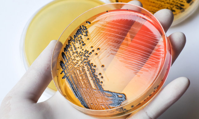 "Клітини-домосіди" допоможуть боротися з небезпечною інфекцією