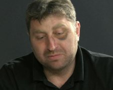 Ради забавы луганскому депутату подкинули отрезанную голову