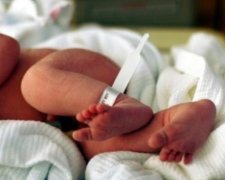 Врачи разделили сросшихся грудью младенцев