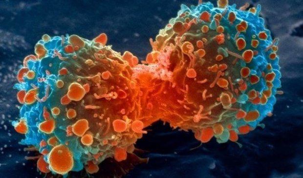 Ученые показали процесс развития раковой опухоли