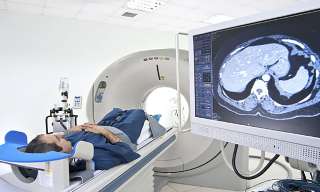 Хвороби легенів і деменція: знайдено несподіваний взаємозв'язок