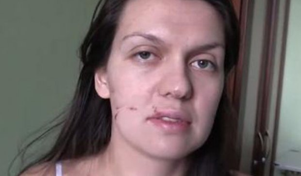 В московской клинике врач жестоко избила  беженку из Донбасса — СМИ
