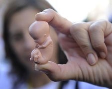 Законопроект об абортах все-таки протащили в Раду