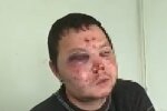 Водія таксі побили після зауваження про маски, кадр з відео
