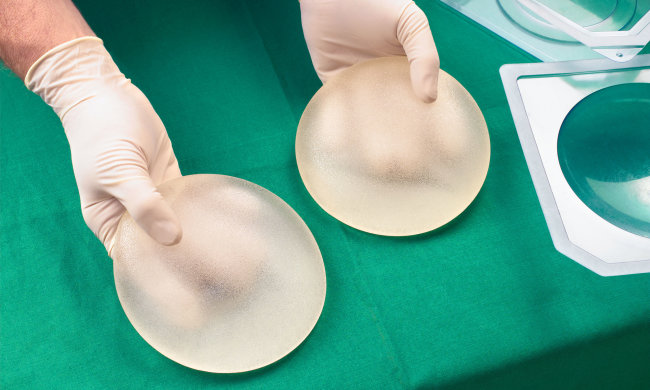 Пластика сідниць обернулася для жінки страшною хворобою: лікарі звинувачують імпланти