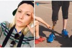 Модель втратила ногу через тампони (фото)