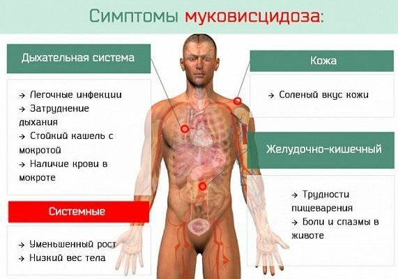 Врожденные заболевания детей (наследственные болезни)