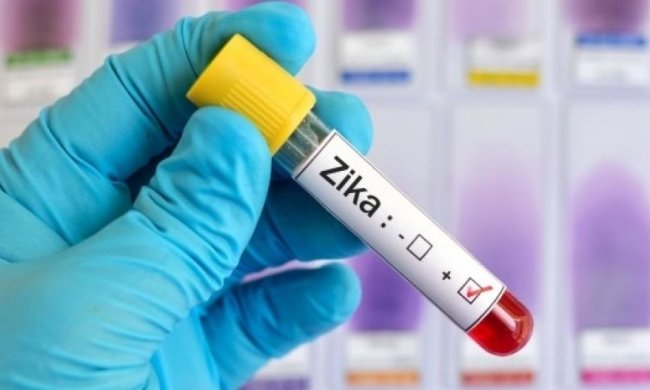 Вчені знайшли ліки від вірусу Зіка в тілі людини