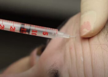 Укол ботокса, скріншот: YouTube