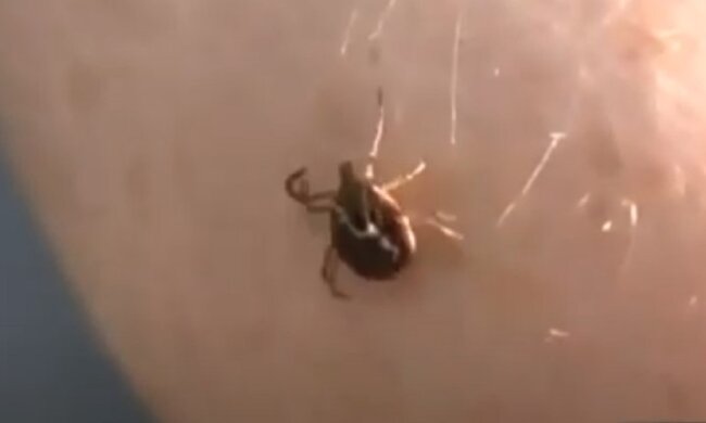 Укус клеща. Фото: Youtube