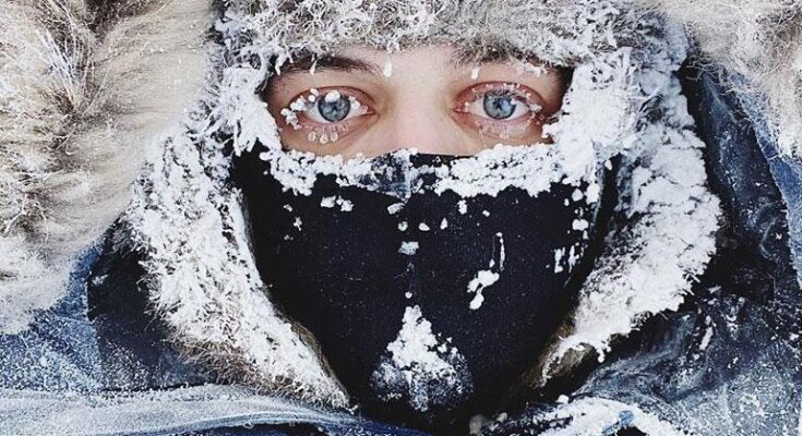 Обмороження