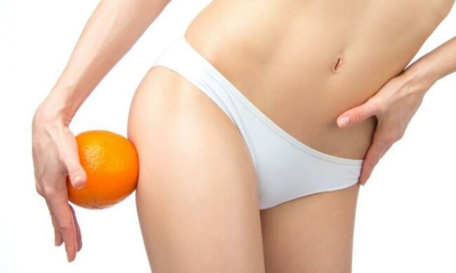 Диетологи назвали лучших друзей целлюлита