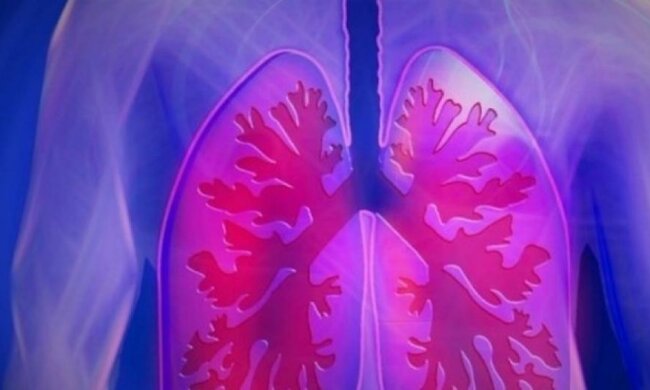 Рак легенів можна перемогти завдяки смартфону