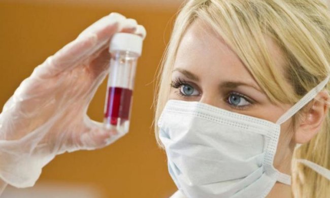 Жуткая статистика: кто больше всего подвержен ВИЧ