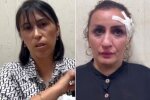 Повідомляється, що жінка продала свого новонародженого сина, щоби заплатити за пластику носа