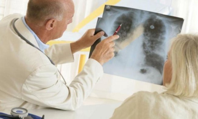 Так не работает: ученые расстроили любителей "побаловаться" сигаретой