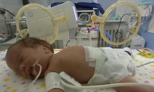 новонародженій дівчинці потрібна операція, фото: Facebook Мама і немовля