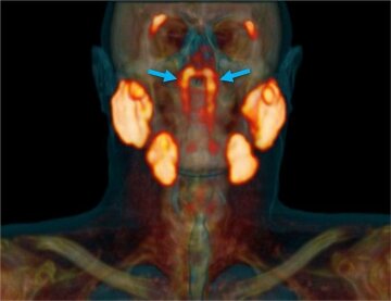 фото Radiotherapy and Oncology