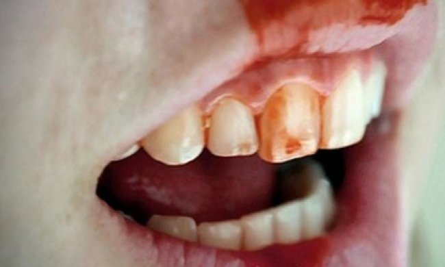 П'яний чоловік покусав копа