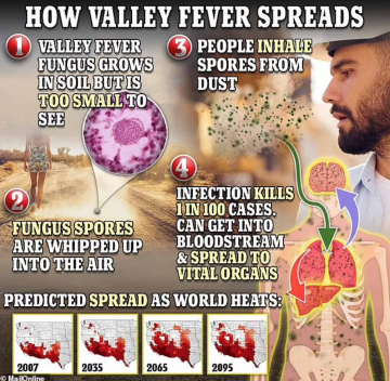 Кокцидіомікоз (Valley Fever) / фото: Daily Mail