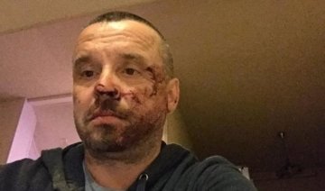  Милиция в Мариуполе избила украинского политика