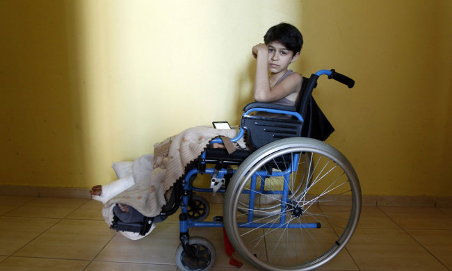 На Ивано-Франковщине подростку поставили четыре неизлечимых диагноза, но он не сдался: история маленького, но очень сильного украинца