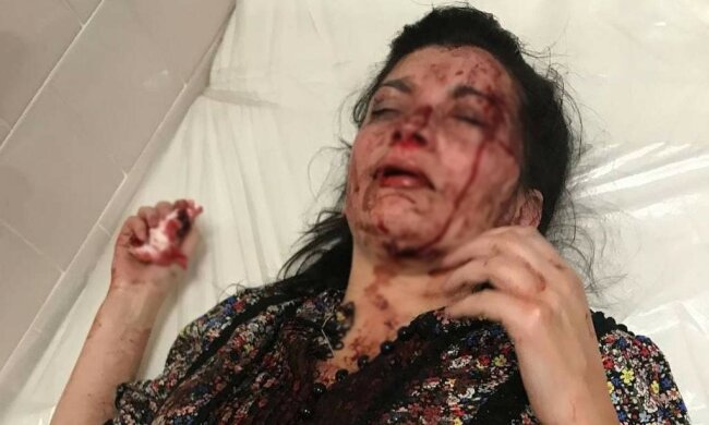 Побита активістка, фото: Підслухано в поліції