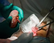 В Індії затримали банду торговців нирками