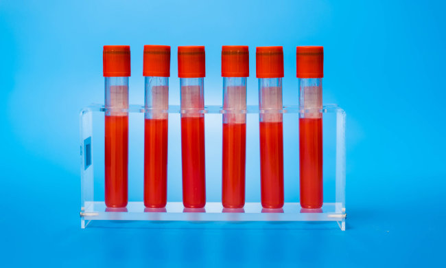 Малою кров'ю: кардіологи навчилися передбачати інфаркт на 10 років вперед