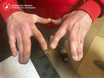 Игнорирование болезней в ТЦК. Фото: facebook/Дмитрий Лубинец