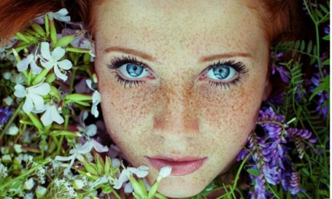 5 порад для тих, хто має веснянки