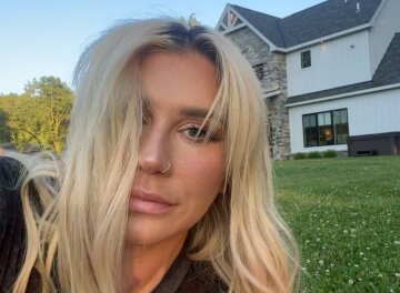 Kesha (Кеша), фото із соцмереж співачки