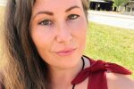 Лицо красавицы превратилось в фарш после нападения пса: шрамы на всю жизнь