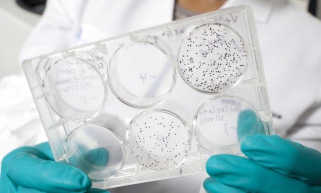 Ученые побороли ВИЧ