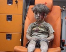 Брат символу сирійської війни помер від поранень