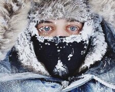 Обмороження