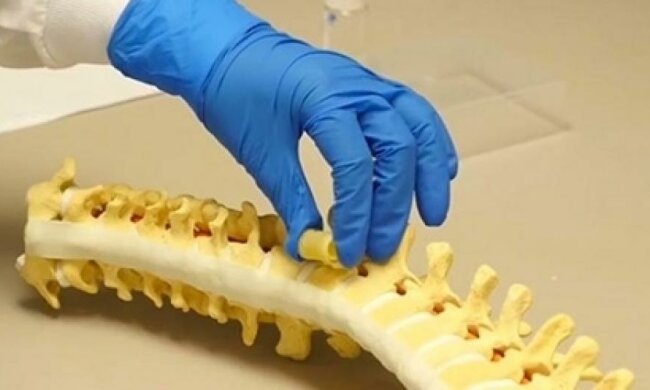 Американські вчені навчилися відновлювати спинний мозок