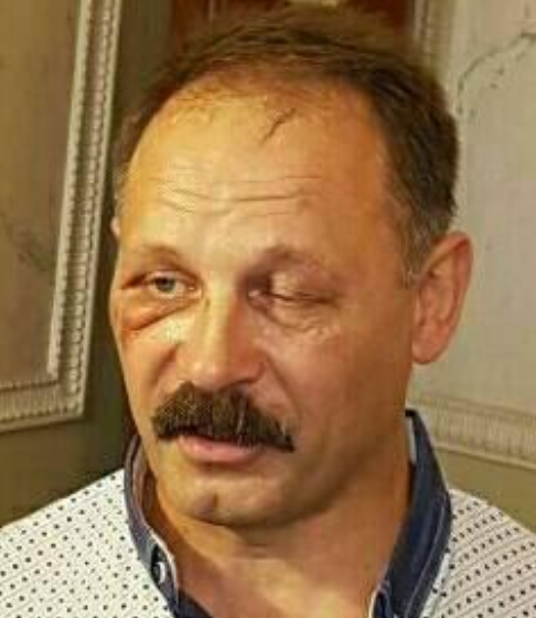 Избитый "слуга народа" Соломчук предложил изолировать "биологическое существо" Барну - Цензор.НЕТ 1584